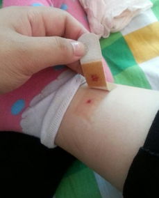 梦见蚂蝗咬手，梦见蚂蝗咬住