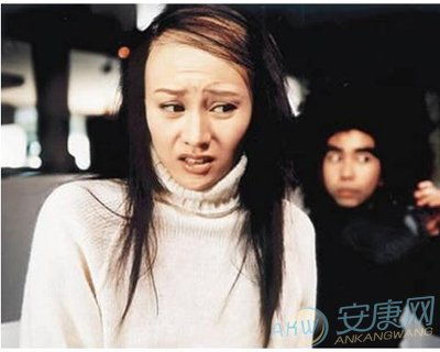 梦到秃顶了怎么回事，做梦秃头顶什么意思