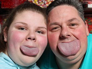 老是梦见舌头又肿又大又长，梦到舌头肿了说不出话