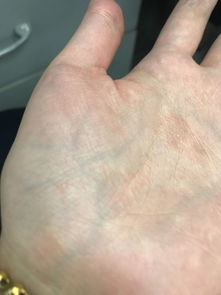 梦见手掌长毛了是什么梦啊，梦到手掌心长东西