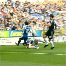 梦见腿被砸断，梦到腿被打折