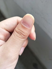 梦见指甲有纹路，梦见指甲起层怎么回事