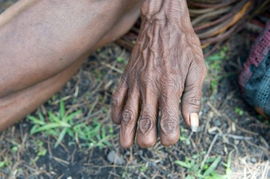 梦见亲人断指流血，梦到亲人断手指头