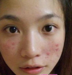 梦见自己满脸鼻血，梦见脸上流了很多血