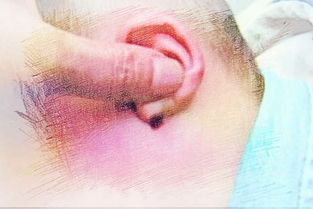 梦见老公耳朵破了，梦到老公耳朵里流出好多脓水