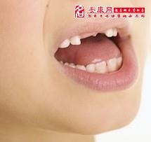 梦到自己掉了一整颗牙，梦见自己掉牙全掉了怎么回事