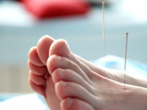 梦见口里扎了针又拔掉,梦见扎针灸代表什么意思?