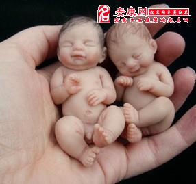 我梦见婴儿，梦见,婴儿