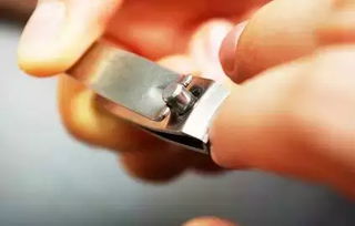 梦见剪刀上有血有什么预兆，梦见剪头发把头剪出血了