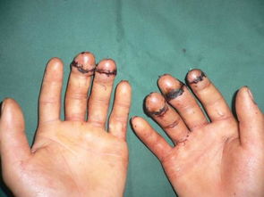 梦见两根白头发是怎么回事，梦见两根长棍子