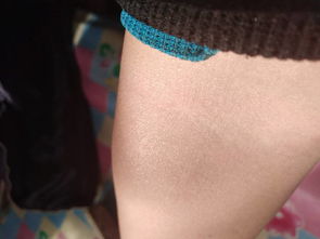 梦见在胳膊上抽血了，梦见从胳膊抽血献血解梦