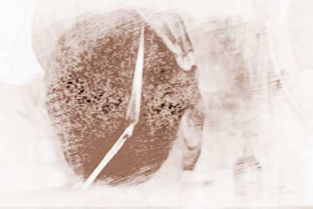 梦见烧了头发是什么意思,梦见火烧头