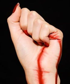 梦见不出血，梦到自己内出血,看不见血