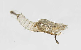 梦见孑孓敷在身上,很难弄下来，梦见宗子