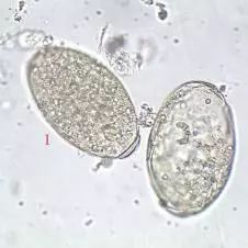 梦见吸虫和蛇，梦见吸血大虫