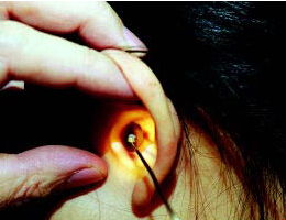 梦到掏耳屎掏出一大坨意味着什么，做梦梦到掏耳屎