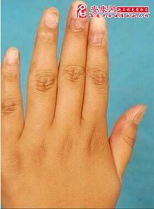 梦到掉手指头没流血怎么回事，梦到掉手指是什么预兆