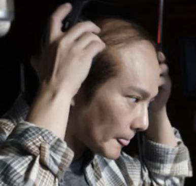 梦到前任秃顶了,梦见前任头发白了什么意思