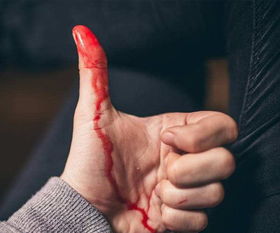 梦见出血好还是不出血好呢，梦见出血了预示着什么