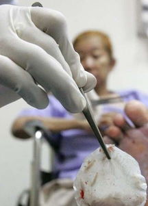 梦见伤口有蛆，梦见自己的伤口生蛆了是什么意思