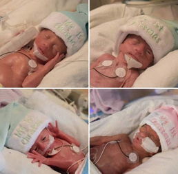 梦见四胞胎男婴什么预兆，梦见四胞胎婴儿好不好