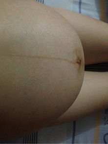 孕晚期梦到宝宝出生了还冲我笑，孕晚期梦到宝宝出生脐带还在脖子上