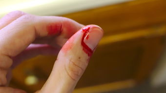 梦到手背割破流血,绿色得血，梦见自己的手背被割开了流了好多血