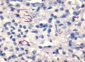 梦见细菌，梦到菌类是什么意思