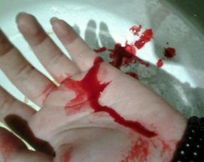 梦到流血是什么意思，梦到流血不止是什么征兆