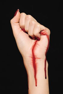 做梦牙掉了没出血周公解梦，梦到眼睛出血周公解梦